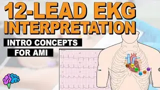 Introductory Concepts for Acute Myocardial Infarction (AMI) on 12-Lead EKG