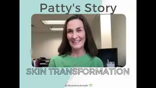 Skin Transformation Testimonial - Patty's Story