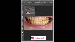 Easy way to whiten tooth - #photoshop #shorts