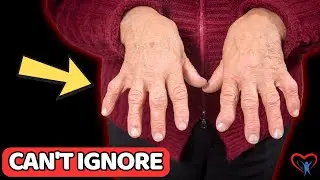 THE TRUTH About FINGER ARTHRITIS That Seniors Cant Ignore | Vitality Solutions