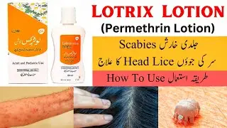 Lotrix Lotion | Permethrin Lotion How To Use | Scabies And Head Lice Treatment Urdu/Hindi