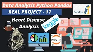 16. Heart Disease Analysis | Python Pandas Project