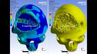 Short Distance Headshot with Bullet Passing thru Helmet, Head and Brain - ANSYS WB Explicit Dynamics