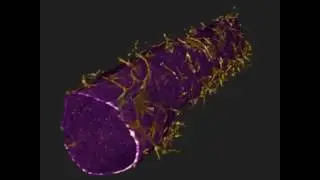 The Blood Brain Barrier