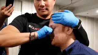 Chris Leong | Broken Nose😱😰