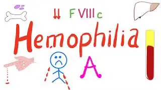 Hemophilia A - Bleeding - Most Comprehensive Explanation - Hematology, Bleeding, and Coagulation