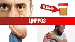 7 главных признаков цирроза печени 📢