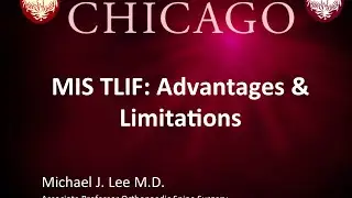 MIS TLIF: Advantages & Limitations by Michael J. Lee, M.D.