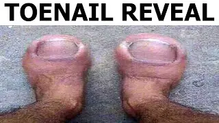 Toenail Reveal 😳