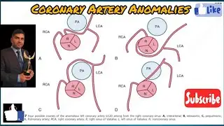 #coronary