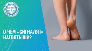 ​🧐 Для чего «нужны» натоптыши? А если просто удалить, в чём опасность?