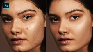 High-End Skin Softening in Photoshop | Remove Blemishes, Wrinkles, Acne Scars, Dark Spots (Easily)