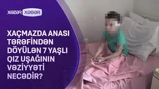 Xaçmazda anası tərəfindən döyülən 7 yaşlı qız uşağının vəziyyəti NECƏDİR?