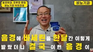 [비뇨기과] 음경에 바세린을 한 달간 이렇게 발랐더니 결국 이런 음경이! 바세린+음경의 생전 처음보는 초대박 효과