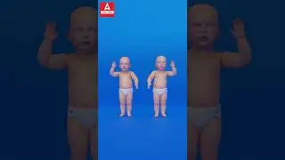 How twins are born #science #sciencefacts #biology #biologyclass12 #shorts