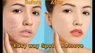 How to Easy way Spot Remove from Image