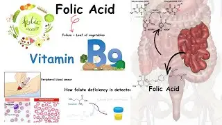 Folate ( Vitamin B9) and folate deficiency