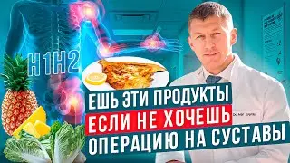 Питание при артрозе. Средиземноморская диета и суставы. Какие продукты полезны для суставов.