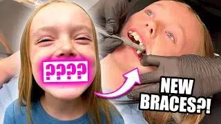 Kalia Gets Braces For The First Time! *SCARY*