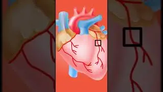 Angina I ذبحة صدرية