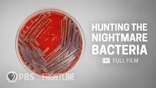 When Antibiotics Dont Work (full documentary) | FRONTLINE