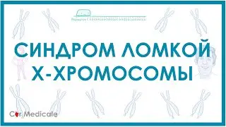 Синдром ломкой Х-хромосомы ака с. Мартина-Белл - механизм развития, причины, клинические проявления