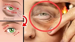 5mins!! Eye Lifting Exercise For Eye Wrinkles, Dark Circle, Eye Bags Under Eyes