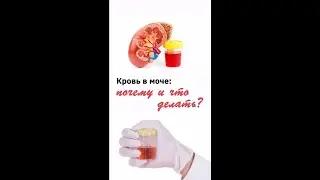 Кровь в моче. Почему и что делать?