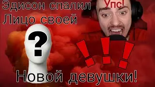 Эдисон спалил лицо своей Новой девушки!?