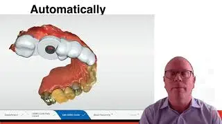 Tip of the Day: New Features in CEREC 5.2