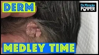 Dermatology Medley Time!