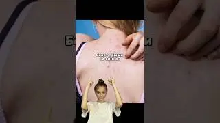Бесят ПРЫЩИ НА СПИНЕ? Попробуй эту сыворотку с салициловой кислотой (Wb: 142054898) #прыщи #уход