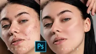 HIGH-END SKIN SOFTENING IN PHOTOSHOP | PHOTOSHOP TUTORIAL