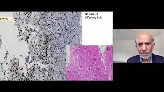 Science of COVID-19: 