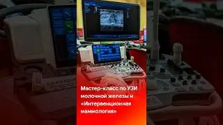 Мастер-класс по #УЗИ молочной железы и курс интервенционная маммология #short #shortvideo #shorts