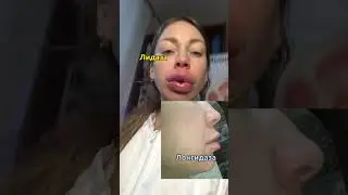 Чем выводить губы , лидаза или лонгидаза ? 