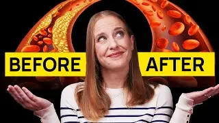 This Enzyme Could Help REDUCE Arterial Plaque by 36%!