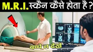 MRI Scan कैसे होता है? | Full Information of MRI Scan | MRI Kaise Hota hai