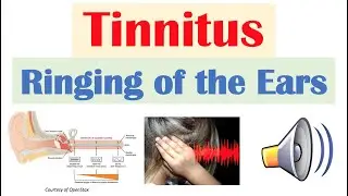 Tinnitus (Ringing of the Ears) Causes, Risk Factors, Pathophysiology, Symptoms, Diagnosis, Treatment