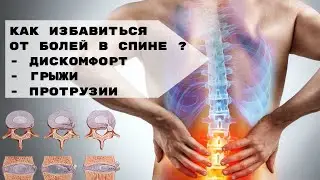 Дискомфорт, Грыжи, Протрузии: Как Избавиться от Болей в Спине ⁉️ Эффективный метод восстановления 🎯