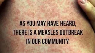 Measles