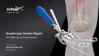 Quadriceps Tendon Repair With PARS Jig and Implant System