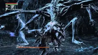 Bloodborne™ Beast Claw Vs Amygdala