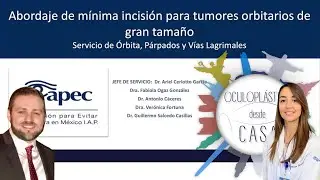 Abordaje de mínima invasión para tumores orbitarios de gran tamaño