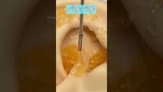 実際にあったら耳が壊れる4種類の耳かき