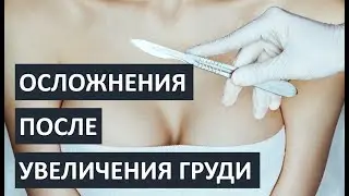 Осложнения после увеличения груди: ЧЕГО БОЯТЬСЯ??