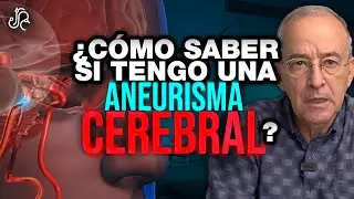 Como Saber Que TENGO Una ANEURISMA CEREBRAL? - Oswaldo Restrepo RSC