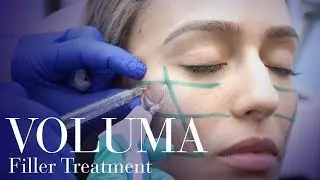 Runway Cheeks! Voluma Cheek Filler