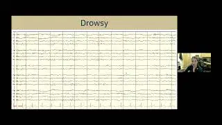 Understanding EEG: A Practical Guide for Patients and Families