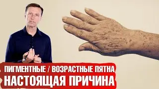 Возрастные пигментные пятна. Как избавиться от печеночных пятен